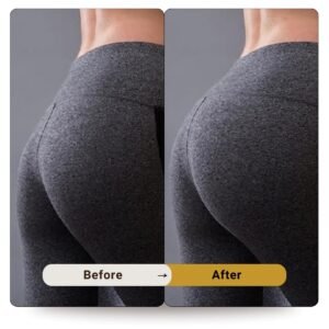 Butt Fillar in dubai before after (2)